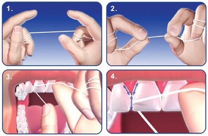Як чистити зубною ниткою (флосом)